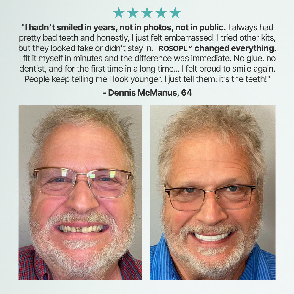 ⚡🏆Ends Today: 70% OFF!🦷DarkFairy™ Custom-Fit Full Functional Dentures Make you more confident