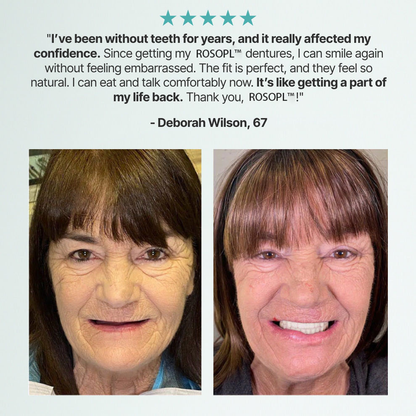⚡🏆Ends Today: 70% OFF!🦷DarkFairy™ Custom-Fit Full Functional Dentures Make you more confident