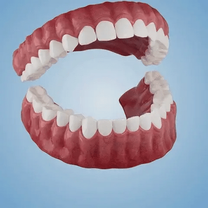 🌎🏆Ends Today: 70% OFF! 🏆2026 Bestselling Product🦷 Fit for a Fresh Smile, Say Goodbye to Wearing Discomfort!